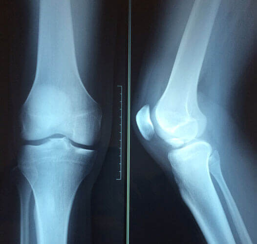 Orthopedic Healthcare Chennai